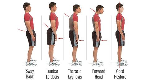 Posture Perfect Are You Standing The Right Way Fitness News The