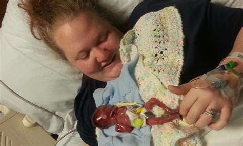 By week 12, the placenta is formed and ready to take over nourishment for the baby. Mother shares powerful photos of baby miscarried at 20 ...