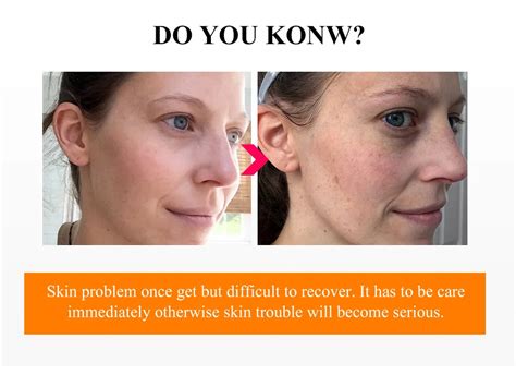 Breylee 6 Types Facial Serum Vitamin C Whitening Retinol Anti Wrinkle 24k Gold Anti Aging Face
