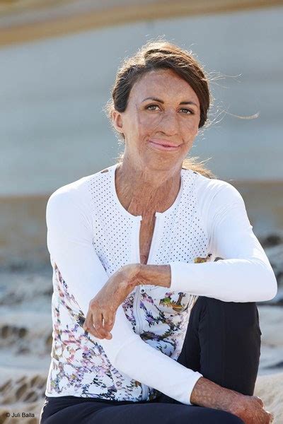 Everything To Live For By Turia Pitt Penguin Books Australia