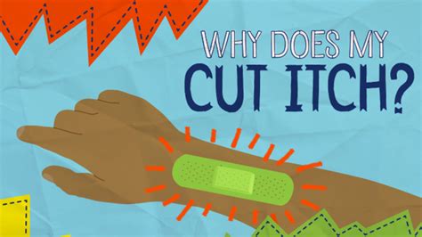 Why Does My Cut Itch Mental Floss
