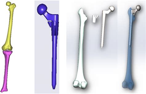 The Cad Models Of The Femur And The S‐rom Hip Implants Were