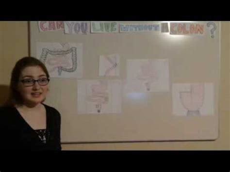 The amount of time she went before being. Can you live without a colon? - YouTube