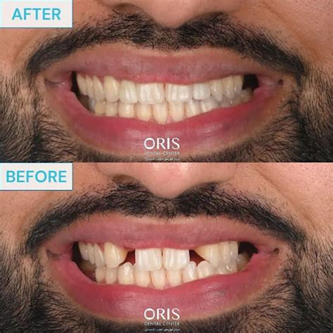 Oris Dental Center Mirdif Dentists In Mirdif Get Contact Number