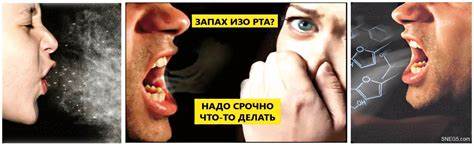 Запах из рта на диете