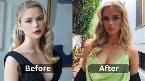 Erin Moriarty Plastic Surgery Before After Myth Or Reality