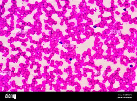 Leukocytes Microscope Hi Res Stock Photography And Images Alamy
