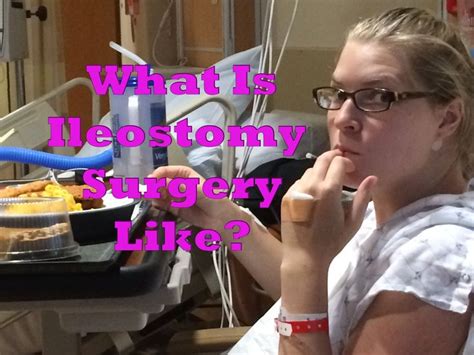 What Is Ileostomy Surgery Like Ileostomy Surgery Ostomy