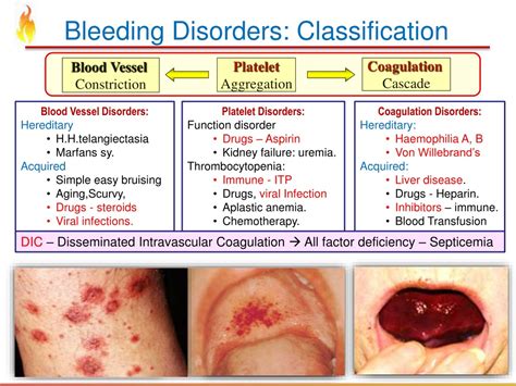 Types Of Bleeding Disorders