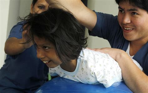 โยวานา ยัมโบ รูซ เด็กพิการ ไร้แขนขา แพทย์เล็งสร้างแขนเทียมให้