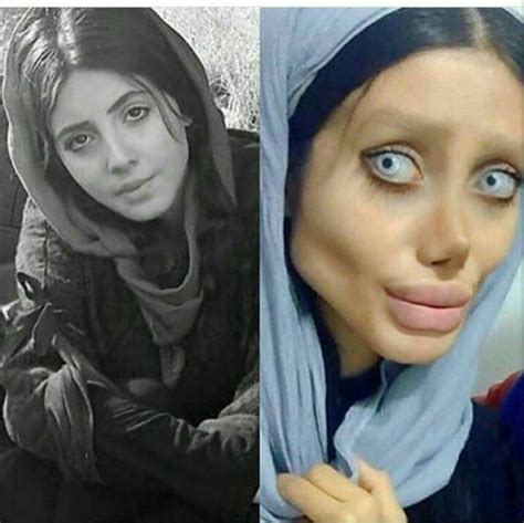 Iranian Teen Sahar Tabar Undergoes 50 Surgeries To Look Like Angelina
