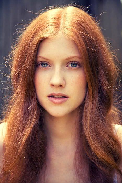 Redheadsmyonlyweakness Light Red Hair Pale Skin Hair Color Natural