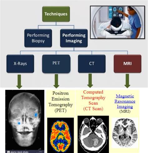 Brain Tumor Imaging Techniques Tahir 2018 Download Scientific Diagram