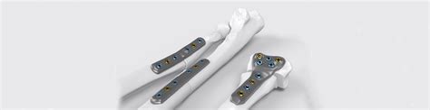 Kls Martin Ips Implants® Forearm Reconstruction