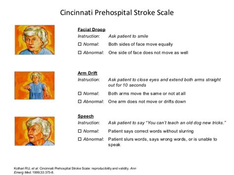 Stroke Assessment Physiopedia