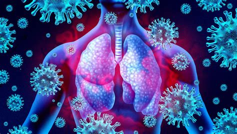 An official website of the national institutes of health. Fallecieron dos personas de Plaza Huincul por COVID-19 ...