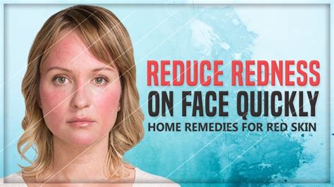 Facial Redness Reduce Redness On Your Face Quickly Youtube