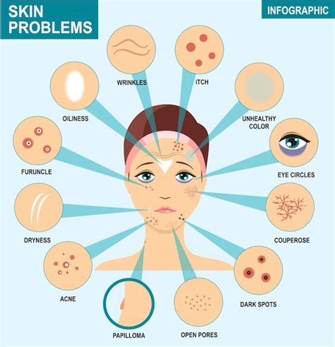 Инфографика проблем с кожей женщина и набор наиболее распространенных проблем с кожей должны