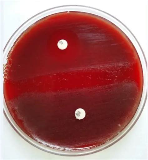 Blood Agar Composition Preparation Uses And Types Of Hemolysis