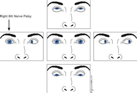 Neurologic Examination Neupsy Key