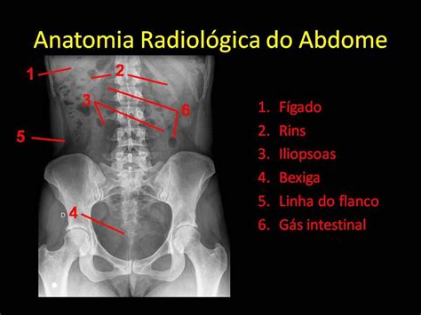 Rx De Abdome Com Fezes