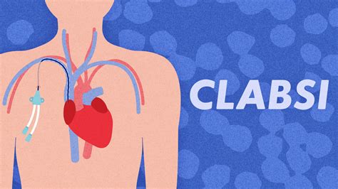 Central Line Associated Bloodstream Infections Ausmed