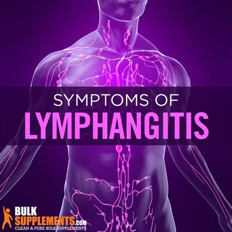 Lymphangitis Symptoms Causes And Treatment