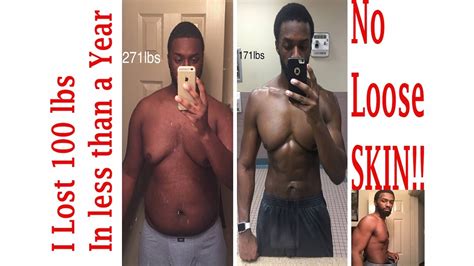 Safely Lose 100 Lbs In Less Than A Year With No Loose Skin Youtube