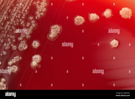 Candida Albicans Cultivo De Hongos Close Up De Una Placa Petri Cultivo