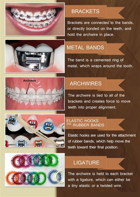 Common Braces And Orthodontic Terms And What They Mean Bozemansmiles Bozemanmontana Braces