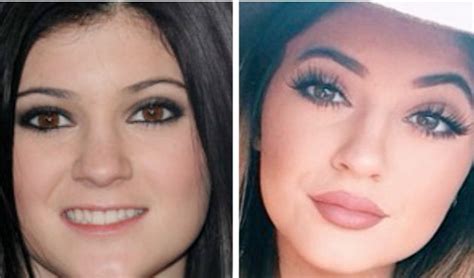 kylie jenner s lips before and after she got injections at least according to the internet
