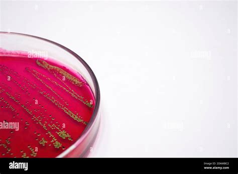 Escherichia Coli Bacteria On Blood Agar Selective Media Stock Photo Alamy