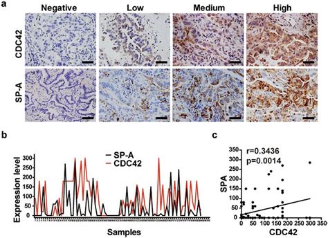 Two monoclonal antibodies to actin: CDC42 expression positively correlates with alveolar ...