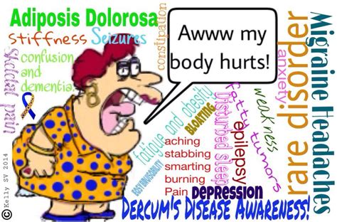 Pin On Adiposis Dolorosa Also Known As Dercums Disease Is A Rare