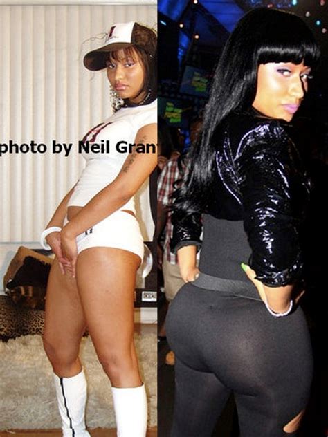 Nicki Minaj Buttocks Before And After Butt Implants