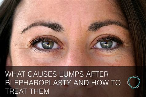 What causes swelling after surgery. What causes lumps after Blepharoplasty and how to treat them
