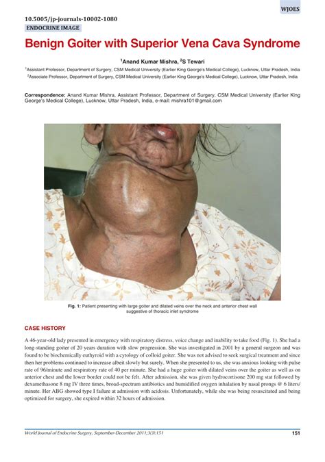 Pdf Benign Goiter With Superior Vena Cava Syndrome