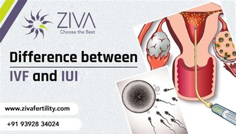 Difference Between Ivf And Iui Ziva Fertility