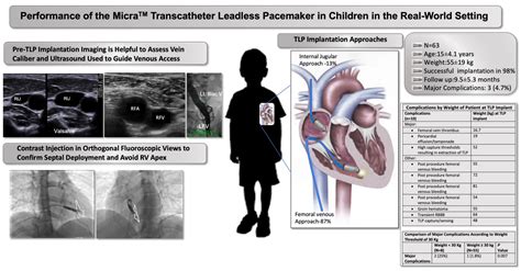 Transcatheter Leadless Pacing In Children A Paces Collaborative Study