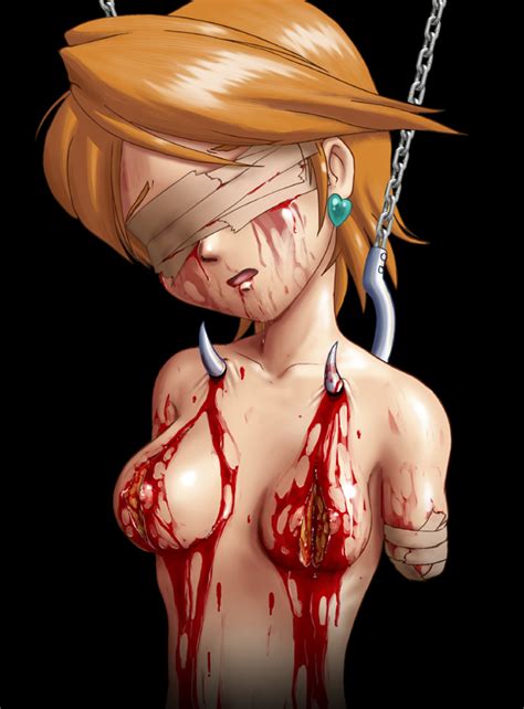 Rule 34 Amputee Bandage Black Background Blood Breasts Color Cure
