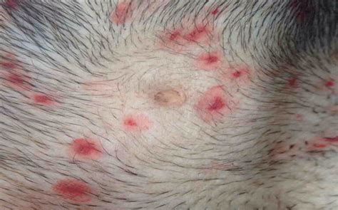 Ringworm in Dogs is Actually Fungus. It Lasts about 3 Weeks to Get Rid of it