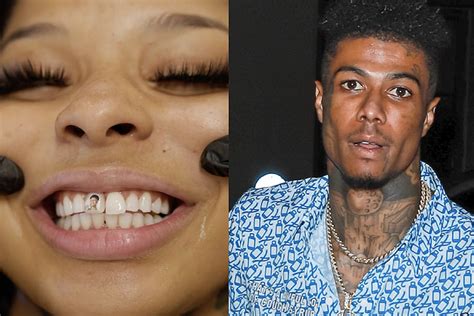 Does Blueface Girlfriend Chrisean Rock Have A New Tooth Does He Have A