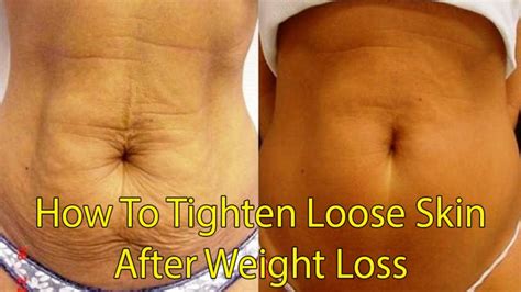 how to tighten skin after weight loss health