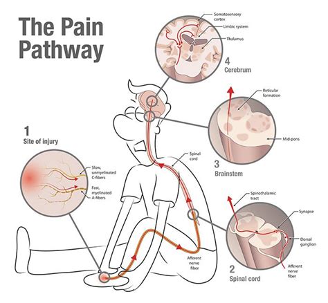 The Pain Pathway Infographic Low Back Pain Pinterest Understand