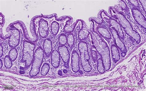Low Magnification Image Of The Glandular Epithelium Of The Gastric Mucosa