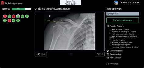 I did one psi exam (scored a 64%); First FRCR Exam - Practice Exam Questions | The Radiology ...