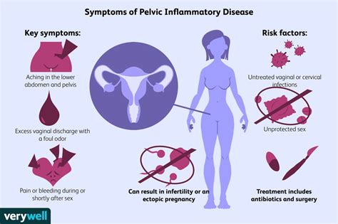 Pelvic Inflammatory Disease Pid Symptoms Causes Diagnosis And