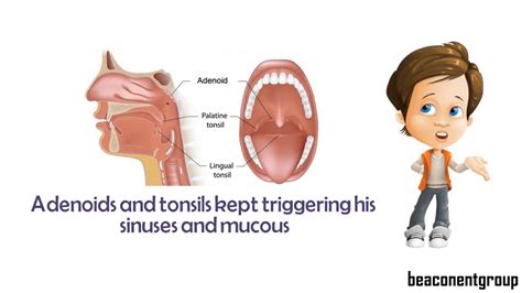 Tonsil Adenoid Anatomy