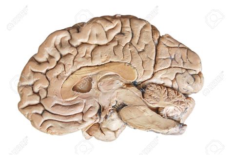 Midsagittal View Cadaveric Brain Lab Quiz 1 Diagram Quizlet