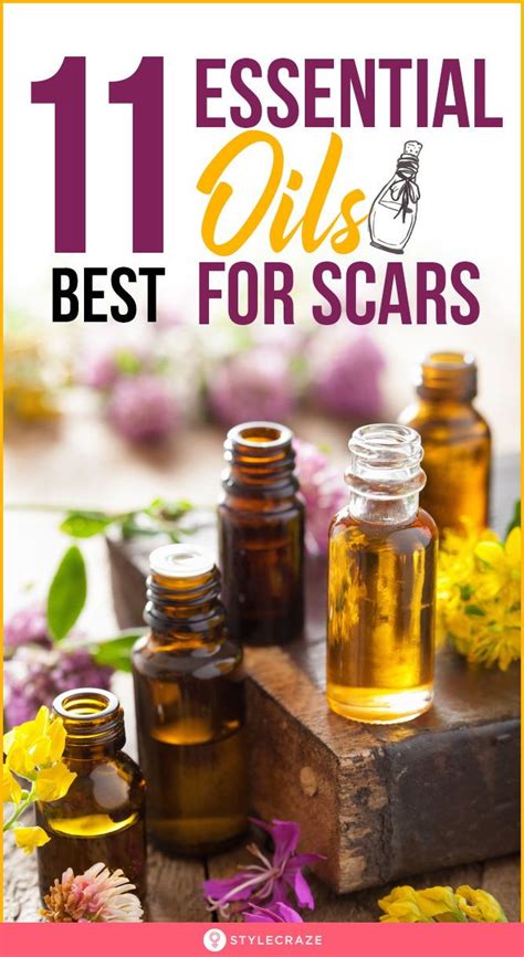 13 Best Essential Oils For Scars To Reduce And Heal Them Artofit